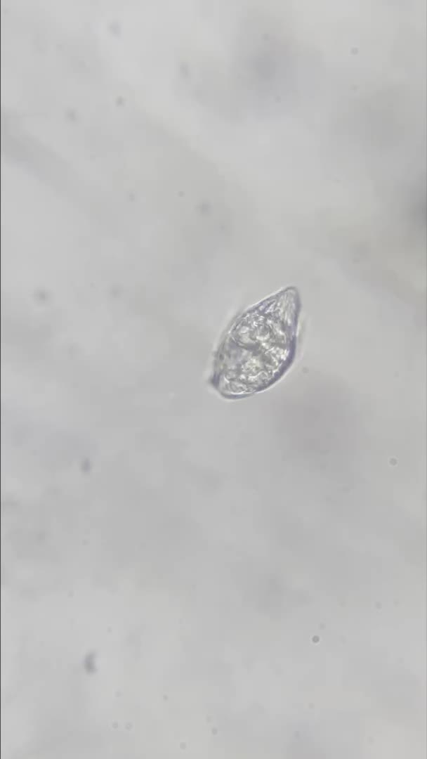 Any idea what is this? 
Sampled it from the strands of dinoflagellates on my scape.